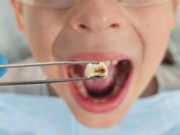 Best Emergency Dentist Near Me  in Union Hall, VA